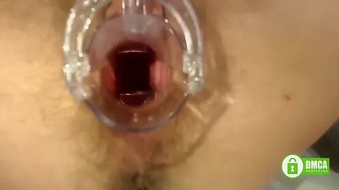 Gyno Exam With Speculum Close Up In Hairy Pussy