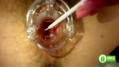 Gyno Exam With Speculum Close Up In Hairy Pussy