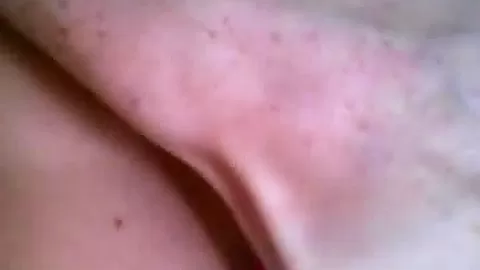 Freckles Tie Dyed Video