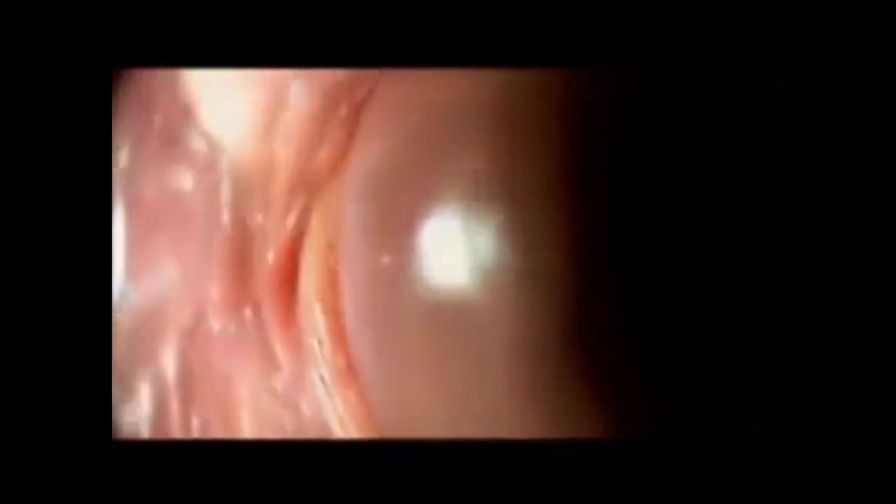 My Ex's Closeup & Personal