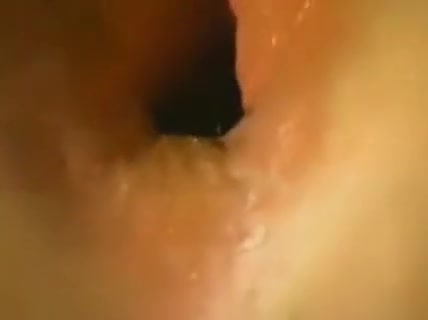 French Porn - Ladyboy Anal Objects Insertion