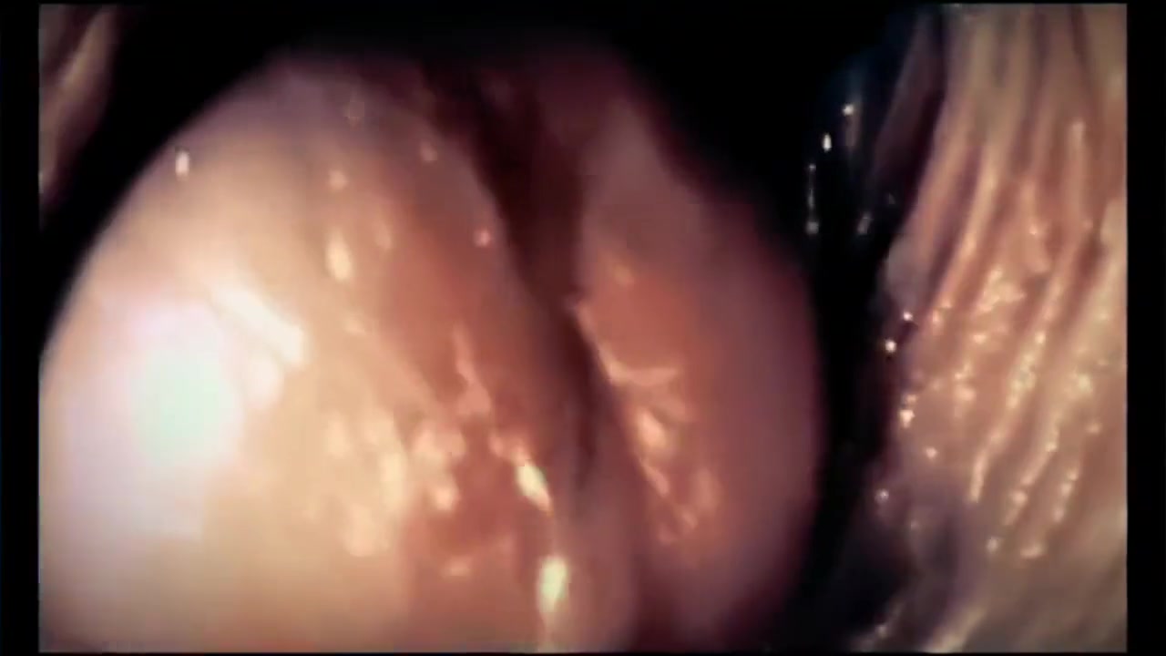 Tombe enceinte